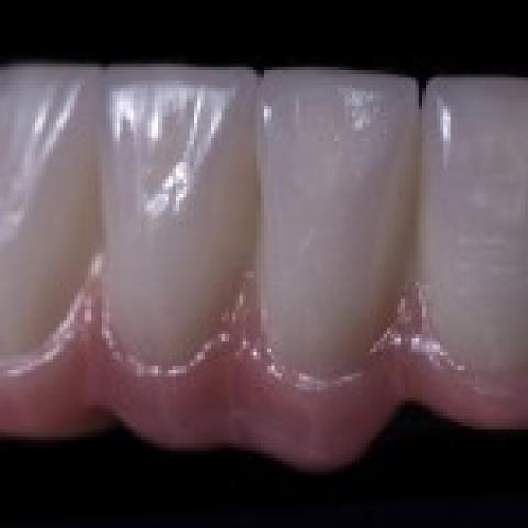 Orthopedic Dentistry