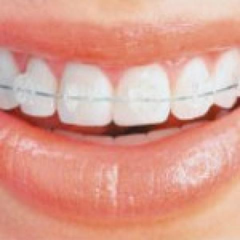 Orthodontic Dentistry